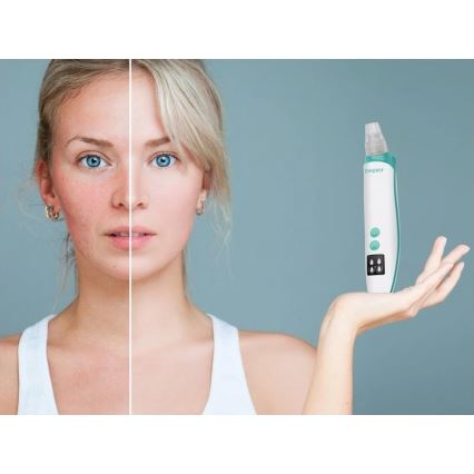 Beper - Limpiador de poros recargable USB/5V 400 mAh